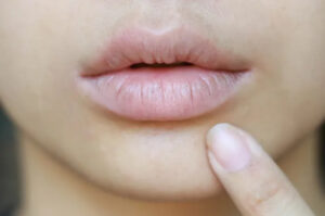Penyebab dan Cara Menyembuhkan Bibir Kering dengan Menggunakan Metode Alami yang Ampuh!